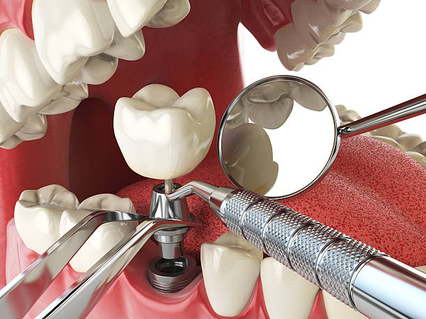 Best Weekend Emergency Dentist in Mendota Heights, MN